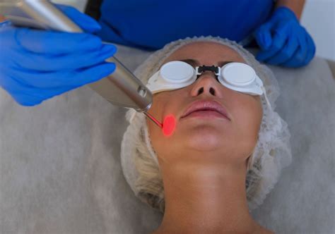 Fotona Laser Non Surgical Face Lift North Toronto Laser Med Clinic