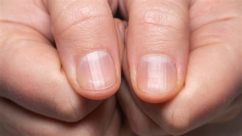 Why Do My Fingernails Grow Faster In A Hot Country Bbc Science Focus