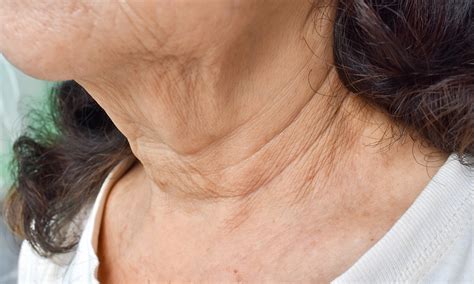 Neck Lines Medical Aesthetics And Wellness Center Located In Scottsdale