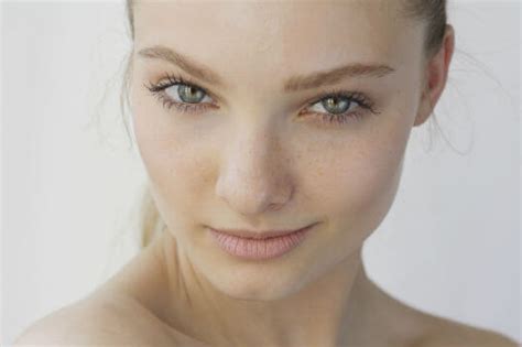 Popular Reasons People Seek Acne Treatment Md Beauty