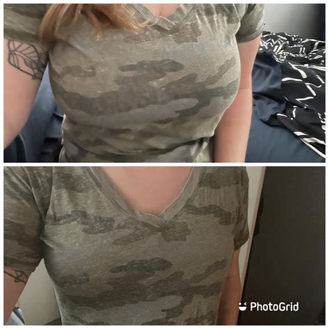 First Time Putting On This Shirt Post Op Scrolller