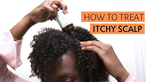 deal with an itchy scalp causes remedy and prevention in 2020 dry hair care afro hair care