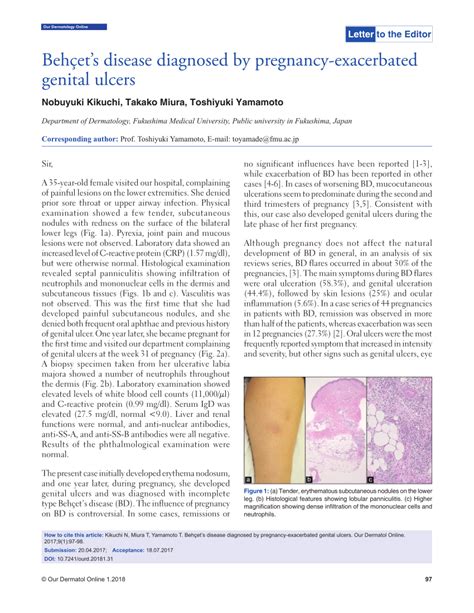 Pdf Behçets Disease Diagnosed By Pregnancy Exacerbated Genital Ulcers