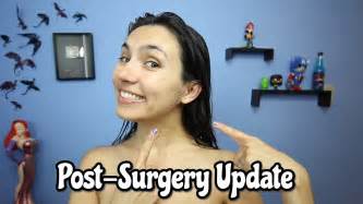 Post Surgery Update Other Announcements Naked Truth Youtube