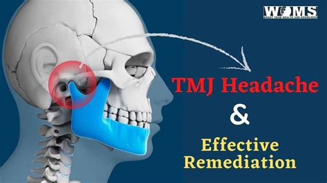 The Discomforting Tmj Headache And Its Effective Remediation Woms