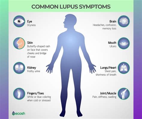 Lupus What Disease Is It And What Causes It Ecosh