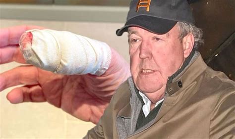 Jeremy Clarkson Taken To Hospital After Slicing Thumb Off In Terrifying