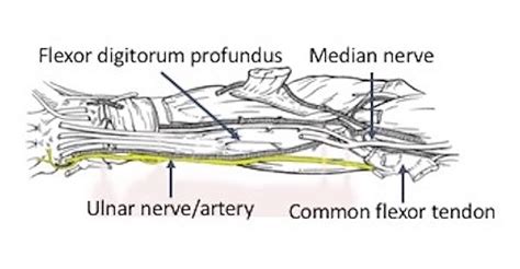 Cureus The Deep Fascia Of The Forearm And The Ulnar Nerve An