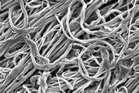 A study on mechanical and morphological analysis of banana/sisal fiber reinforced ipn composites. Novel ultrafine polymer fibers stronger and tougher than ...