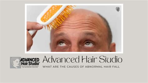 Ppt Know Causes Of Abnormal Hair Loss And Hair Loss Treatment