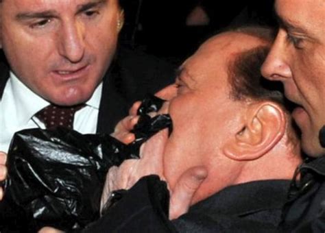 Berlusconi Gets A Broken Nose And Loses Two Teeth During The Assault 7