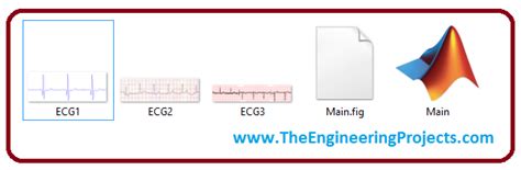 Ecg Digitization In Matlab The Engineering Projects