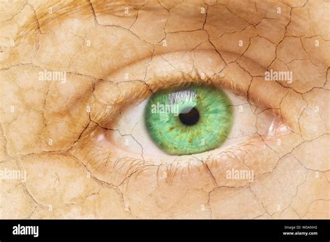 Cracked Skin Closeup Of A Female Eye With Cracked Skin Aging Process