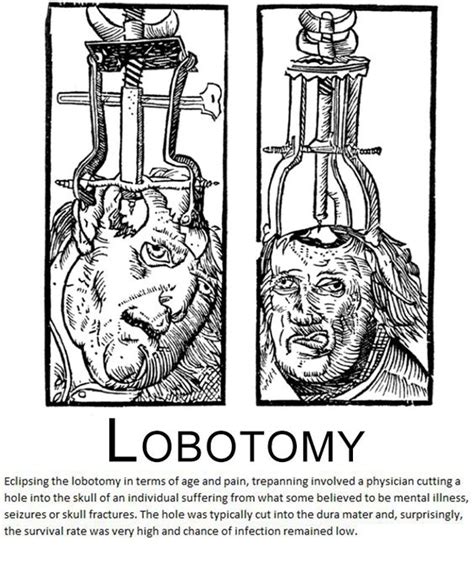 Most Horrible Medieval Surgeries And Medical Procedures Pictures