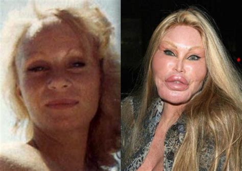 Top 10 Worst Celebrity Plastic Surgery Disasters 2013 2014 Bad