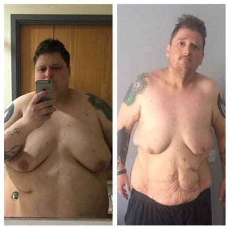 Morbidly Obese Man Loses 33 Stone To Turn His Life Around Wales Online