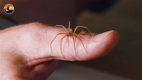 Brown Recluse Spider Bite Thumb