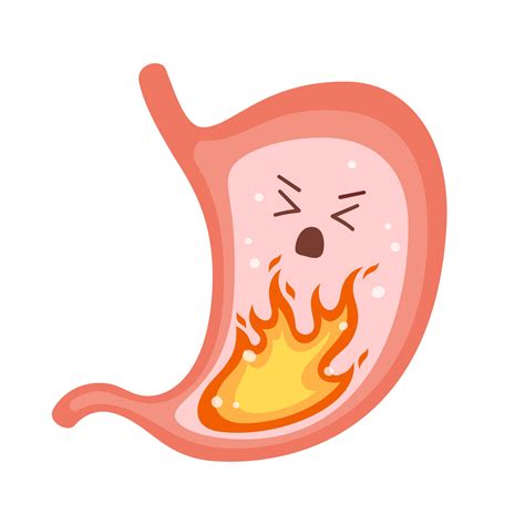 Human Stomach Heartburn Gastritis And Acid Reflux Indigestion