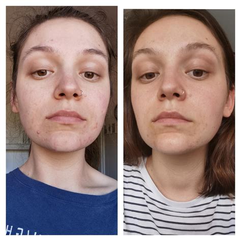 1 Month Vegan Diet Before And After