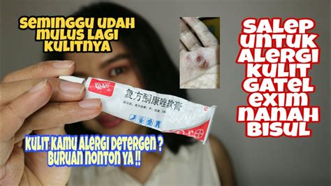 Salep Ampuh Untuk Gatal Gatal Alergi Deterjen Exim Dermatitis Youtube