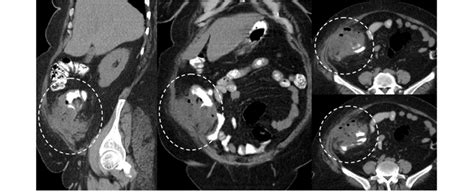Sagittal Coronal And Axial Multislice Ct Images With Oral And Iv