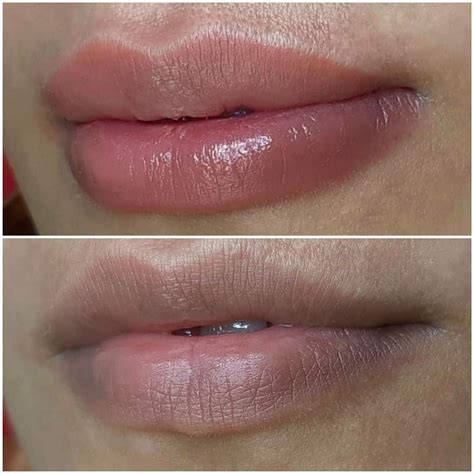 How To Turn Black Lips Into Pink Naturally Artofit