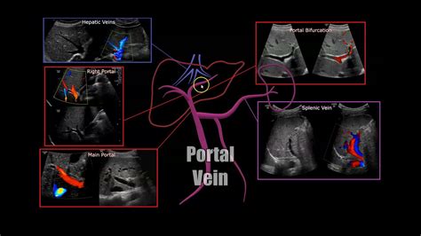 Portal Vein Anatomy Youtube