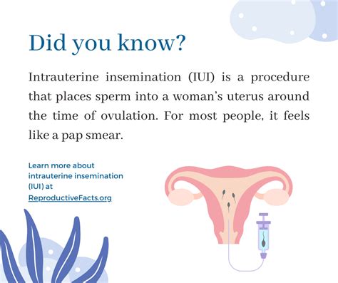 Intrauterine Insemination Iui Infographics