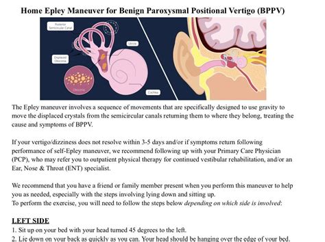 Epley Maneuver Patient Handout For Bppv Etsy Finland