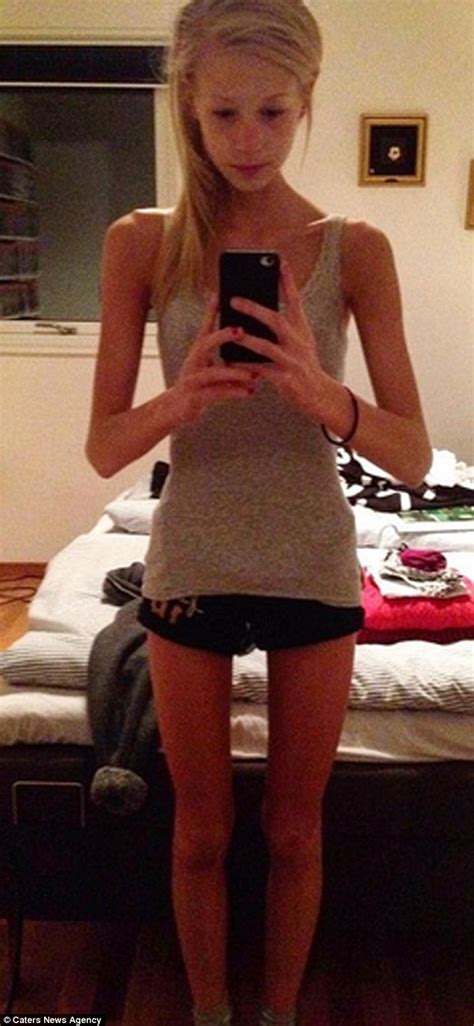 Swedish Anorexic Turned Life Around And Became A Personal Trainer