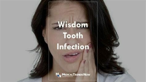 What Causes A Wisdom Tooth Infection And How To Treat Pericoronitis
