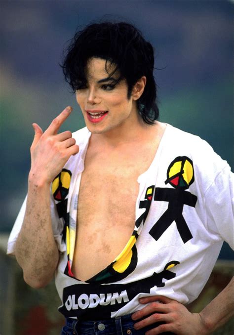 Vitiligo Is Very Apparent Here Michael Jackson Photo