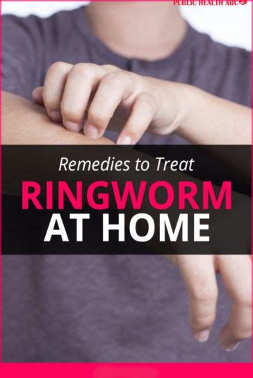 Diy Remedies To Treat Ringworm At Home Health Beauty Abc Home