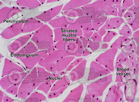 Skeletal Muscle Histology Labeled