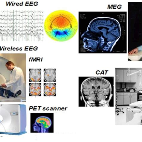 Examples Of Modern Imaging Devices Both Invasive Active Imaging