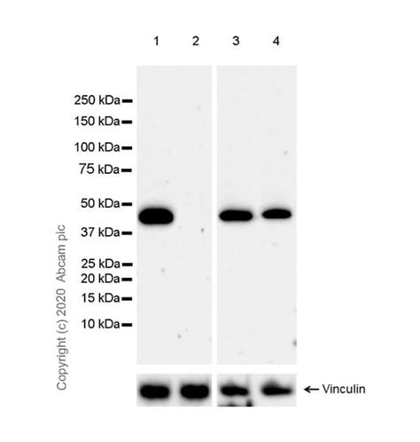 recombinant anti hdac8 antibody [epr23837 45] bsa and azide free ko tested ab274378