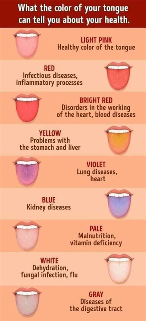 What Your Tongue Colour May Reveal About Your Health