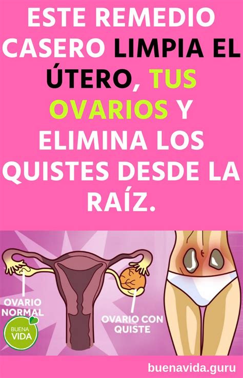 Este Remedio Casero Limpia El útero Tus Ovarios Y Elimina Los Quistes Desde La Raíz Recetas