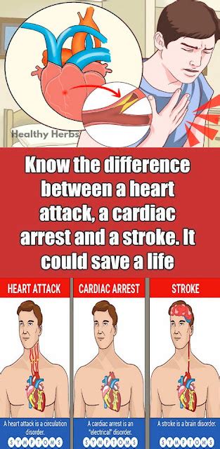 You Must Know The Differences Between A Heart Attack Cardiac Arrest