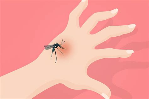 蚊虫叮咬红肿怎么办快速解决被蚊子咬了又红又肿，怎么才能快速消除） 说明书网