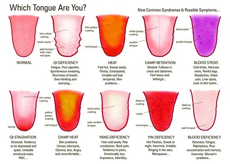 How Your Tongue Can Show Signs Of Gut Problems And Why