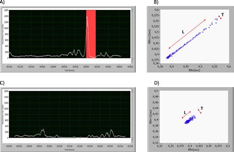 Detection Of Epileptic Seizures With A Modified Heart Rate Variability