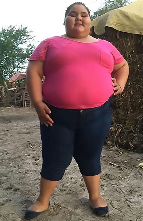 Fattest Teenager In World Sheds St See Her Amazing Transformation