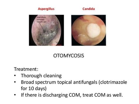 Diseases Of External Ear And Its Management