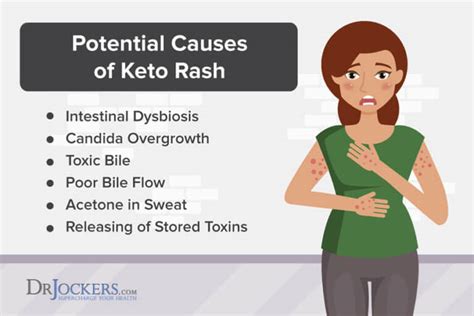 Keto Rash Causes And Natural Treatments