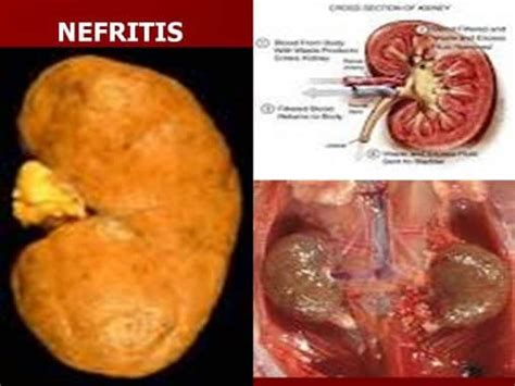 Penyakit gastritis merupakan sebuah penyakit karena terjadinya peradangan pada mukosa lambung. 9 Macam Gangguan Sistem Urinaria pada Manusia
