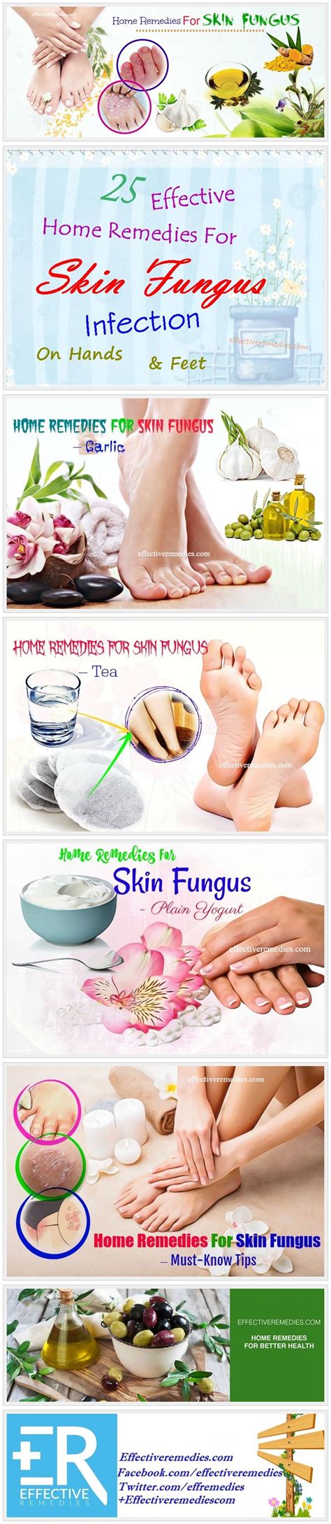 25 Effective Home Remedies For Skin Fungus Infection On Hands And Feet
