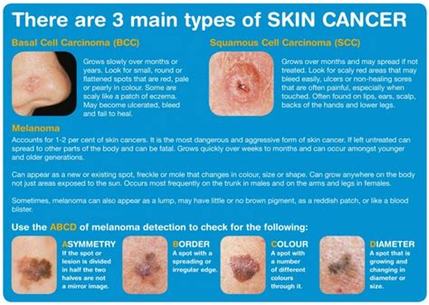 Skin Cancer Awareness Mum Thats Me