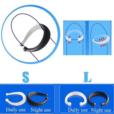 2pcs Cock Ring Peins Foreskin Correction Cockring Sex Shop Couple Rings Chastity Cock Cage Sex