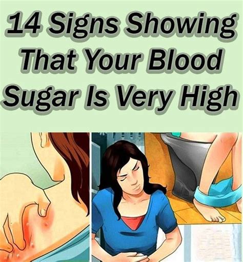 14 Signs Showing That Your Blood Sugar Is Very High — Info You Should Know